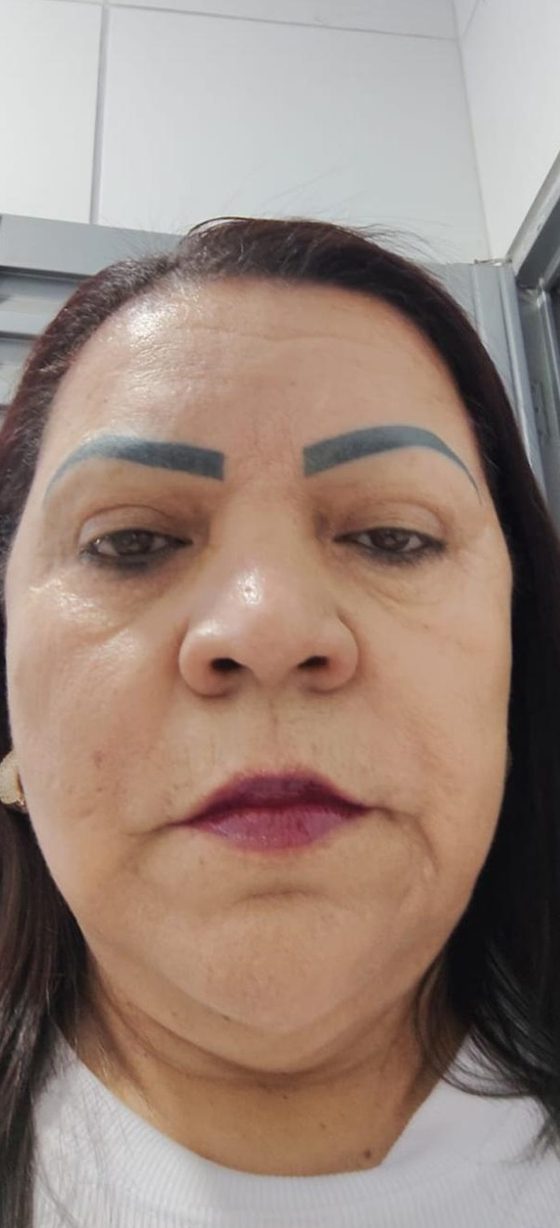 Depois