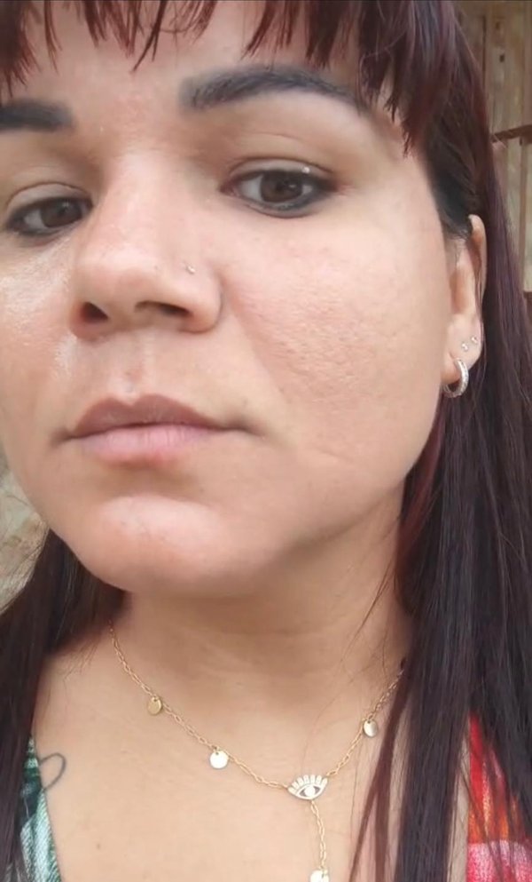 Antes
